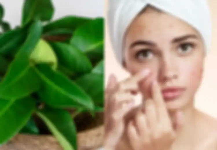 Manfaat Daun Salam untuk Hilangkan Jerawat dengan Cara Membuat Masker