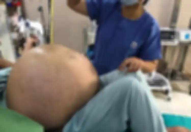 'Saya Belum Pernah Melihat yang Seperti Ini', Inilah Cerita Dokter yang Berhasil Mengangkat Tumor Ovarium Seberat Remaja 15 Tahun dari Perut Seorang Wanita