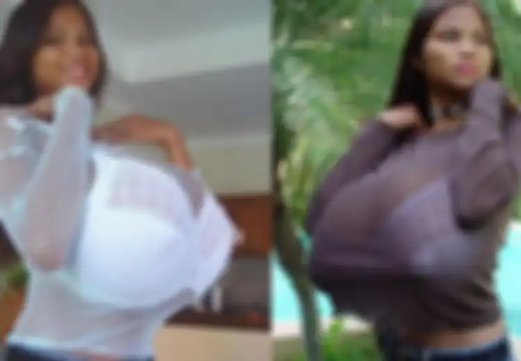 Tanpa Dioperasi Atau Silikon, Payudara Gadis Ini Tumbuh Alami  Dengan Ukuran Tak Masuk Akal Beratnya Mencapai 20 Kg, Bukanya Bahagia Gadis Ini Justru Hidup Menderita