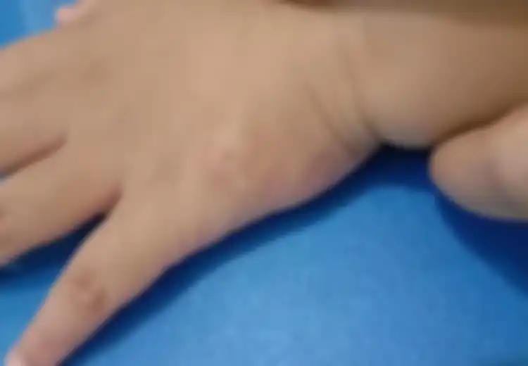 Duh, Kok Bisa Ya? Ada Cacing Hidup di Bawah Kulit Anak Anji, Ini Penyebabnya Salah Satunya Sering Dilakukan oleh Anak-anak