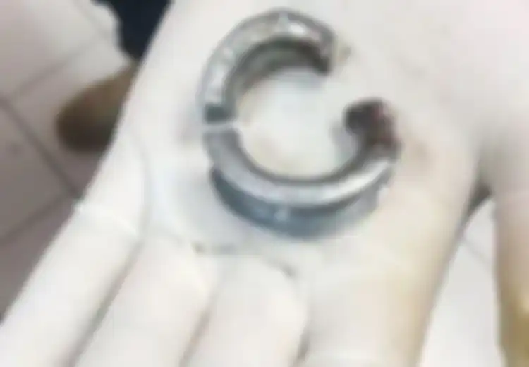 Ingin Buat Pacar Terkesan Saat Hari Valentine, Pria Ini Pasang Cincin Baja di Alat Kelaminnya, Begini Akhir yang Tak Disangka-sangkanya