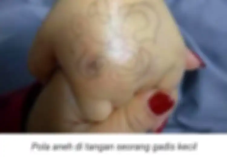 Pulang Bermain Saksikan Ada Gambar Ini di Tangan Putrinya, Sang Ibu Langsung Panik Sampai Lapor Polisi, Ternyata Arti Gambar di Tangan Ini Sangat Mengejukan dan Berbahaya