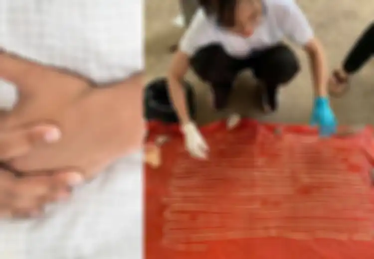 Berawal dari Sakit Perut, Dokter Kaget Setelah Bedah Perut Pasien Ini, Temukan Makhluk yang Dilihatnya Sekali Selama 50 Tahun Memiliki Panjang 18 Meter