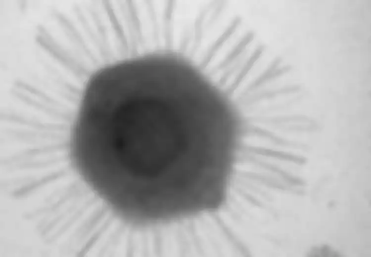 Ditemukan Dekat Dengan Tempat Terdalam di Bumi, Virus Raksasa Ini Gemparkan Ilmuwan Selama Ini Ada di Kedalaman 11.000 Meter, Ini Perbandingannya Dengan Virus Corona