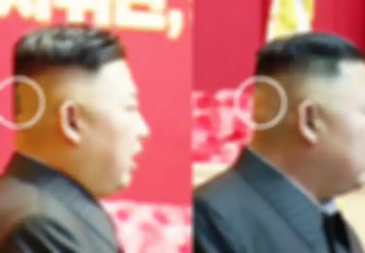 Kesehatannya Sempat Dirumorkan Dalam Kondisi Buruk, Tanda di Kepala Kim Jong-Un Ini Seolah Beri Petunjuk Jika Pemimpin Korea Utara Itu Sedang 'Tidak' Baik-Baik Saja