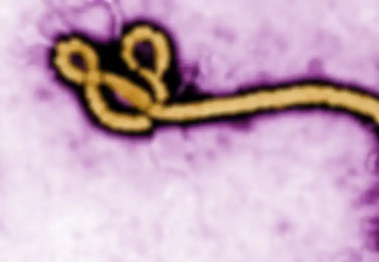 Afrika Barat Dilanda Kemalangan Bertubi-tubi, Covid-19 Belum Tuntas, Wabah Baru Virus Marburg dan Ebola Muncul Menambah Derita