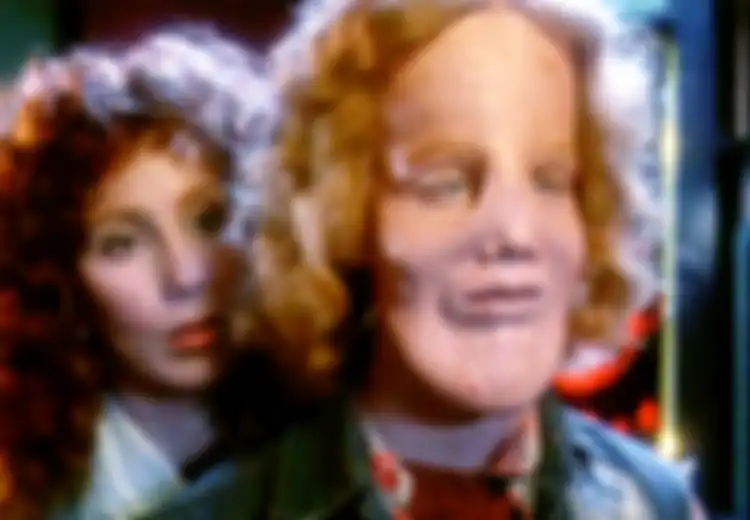 Kisah Hidup Luar Biasa Rocky Dennis, Ketidaknormalan Hidupnya Tak Hentikan Jalani Kehidupan yang Memuaskan, Bahkan Hidupnya Jadi Inspirasi Film Layar Lebar ‘Mask’