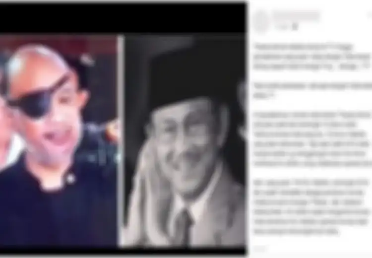 Sampai Picu Hoaks Habibie Donorkan Korneanya, Ternyata Ini Penyebab Thareq Kemal Selalu Pakai Penutup Mata Bak Bajak Laut, Semua Orang Bisa Kena