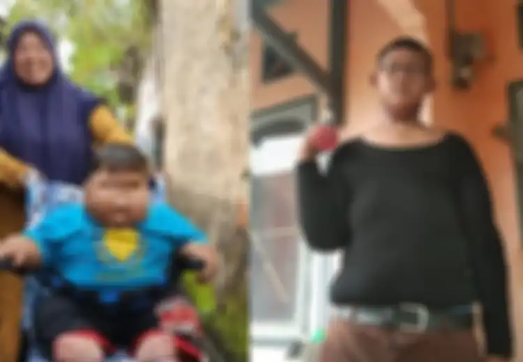 Muncul Balita 16 Bulan Obesitas, Dulu Ada Arya Permana yang Berjuang Turunkan Berat Badan Hingga 100 Kg