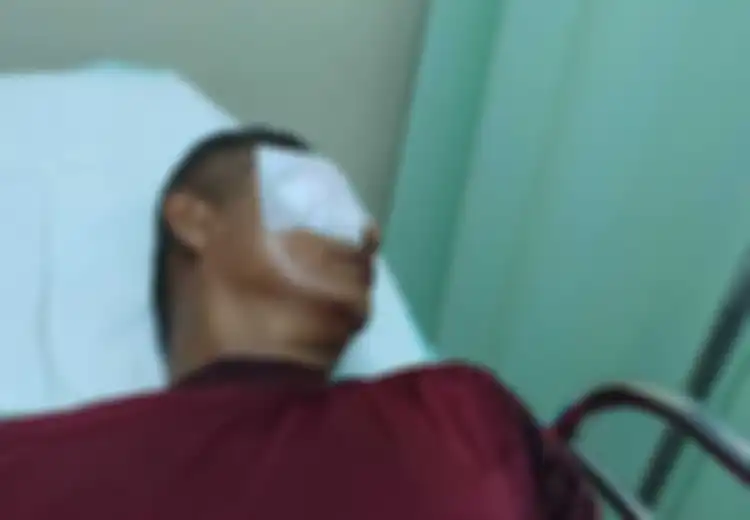 Tegur Siswa Merokok, Sosok Guru Tegas Dan Humoris Ini Diketapel Orangtua Murid Hingga Alami Kebutaan