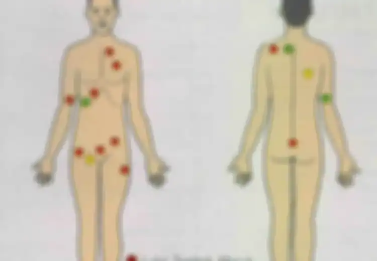 Mengurai Fakta Dari Bangsal Forensik Peristiwa G30S: Tidak Ada Pencungkilan Mata Dan Pemotongan Alat Vital