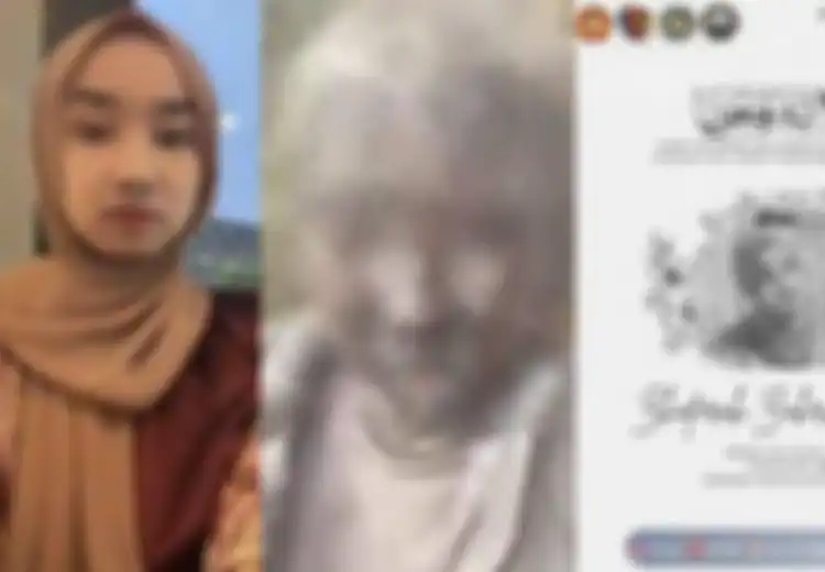 Innalillahi, Zhafirah Zahrim, Mahasiswi Yang Tubuhnya Penuh Abu Letusan Gunung Marapi Kini Meninggal Dunia