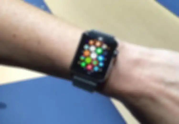 Beberapa Pengguna Jam Tangan Pintar Apple Watch Keluhkan Iritasi Kulit