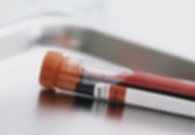 7 Hal Yang Bisa Diintip Dokter dari Darahmu