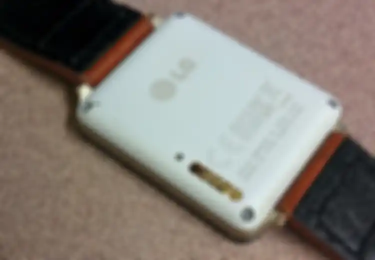 LG G Watch Sebabkan Iritasi Kulit?