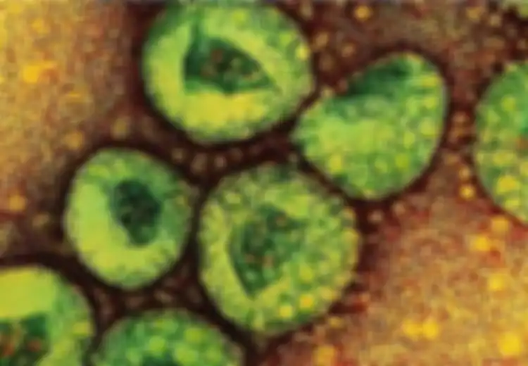 Virus MERS Ditularkan ke Manusia melalui Unta