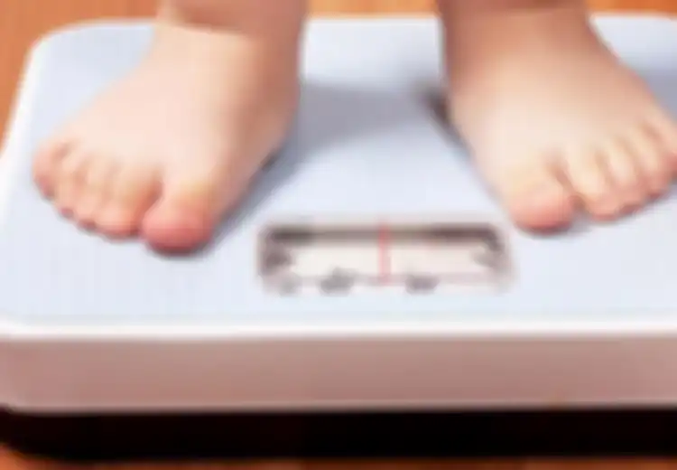 Obesitas Berpotensi Sebabkan Kaki Anak Berbentuk O