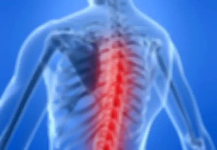 Yuk, Cegah Osteoporosis