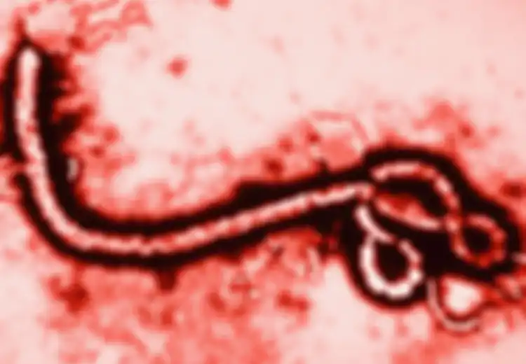 Bukan HIV Atau Zika, Inilah 10 Virus Paling Mematikan Di Dunia