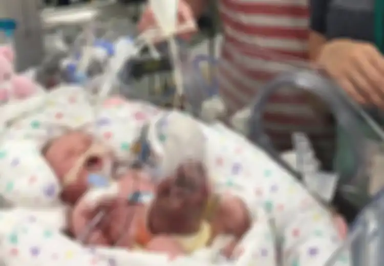 Ketika Lahir, Organ Bayi Ini Berada di Luar, tapi Kini Ia Sudah Segar Bugar!