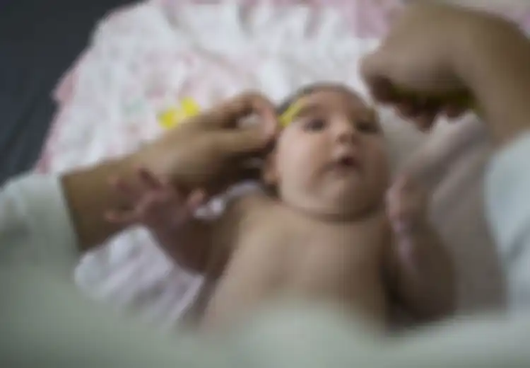 Ini Adalah 6 Alasan Mengapa Ukuran Kepala Bayi Kecil Disebabkan Oleh Virus Zika (1)