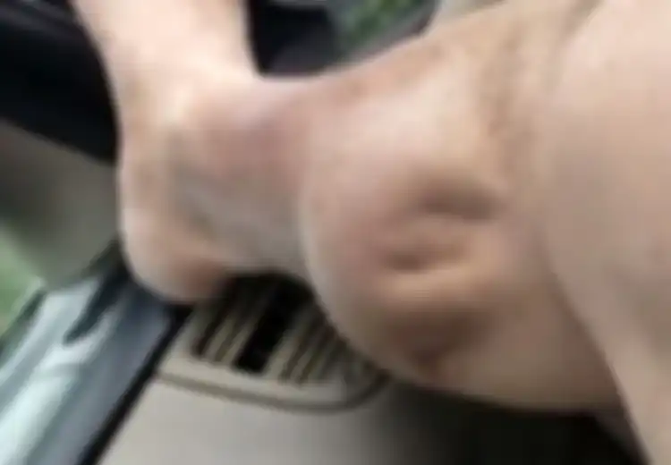 Bagaimana Rasanya Menderita Kram Ekstrem Mirip Alien Seperti Ini?