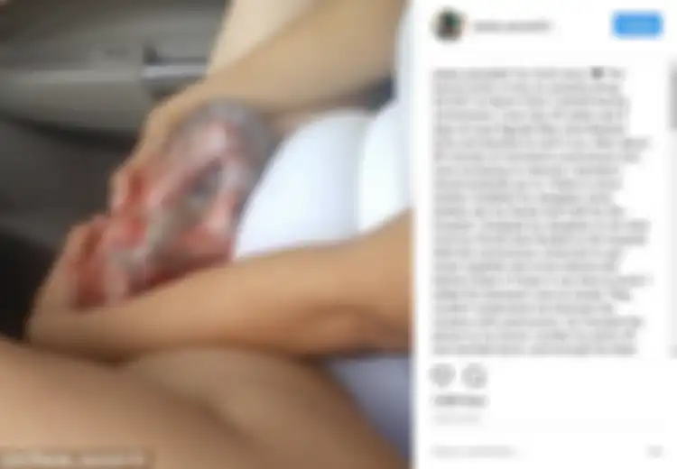 Wow, Bayi Ini Lahir Masih Terbungkus Ketuban. Sangat Langka!