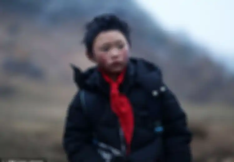 Masih Ingat Bocah Rambut Beku? Karena Kisahnya Mengharukan, Kini Dia dan Anak Lainnya Jadi Dapat Bantuan