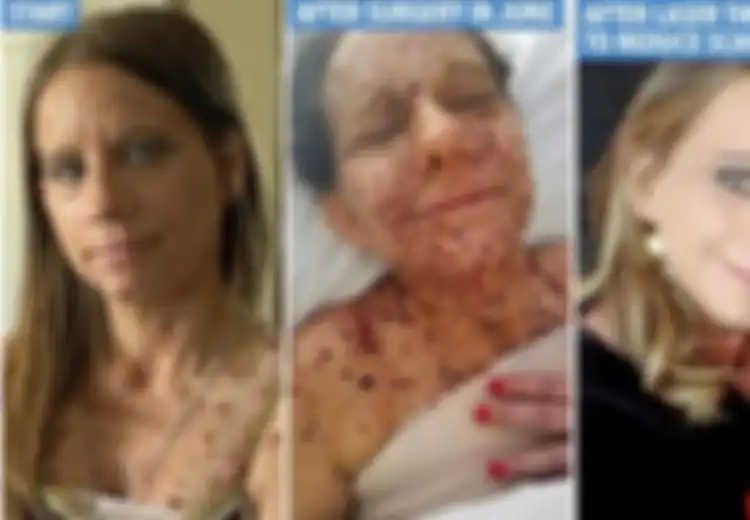 Mirip Dongeng, Bertahun-tahun Dihina Sebagai Kodok, Wanita Ini Kini Berubah Cantik Rupawan