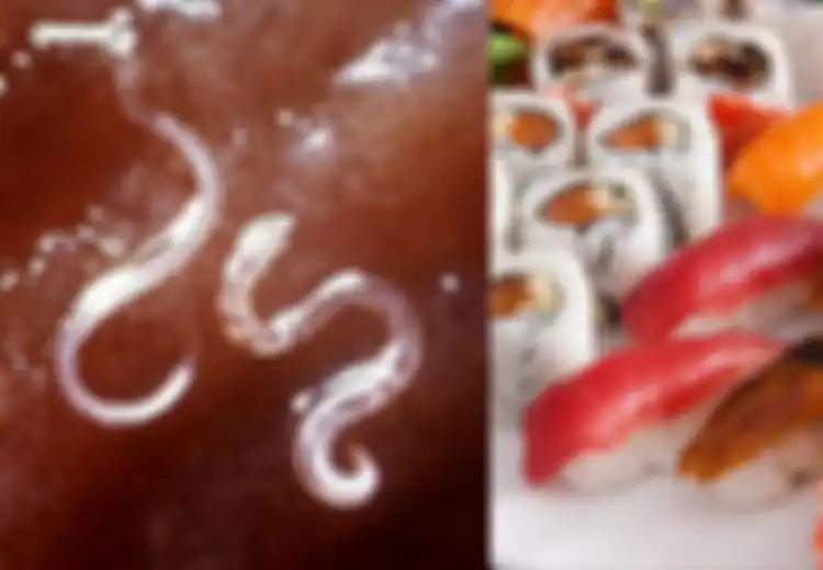 Suka Makan Sushi? Hati Hati, di Usus Pria Ini Ditemukan Cacing Setelah Ia Menyantap Makanan Mentah 