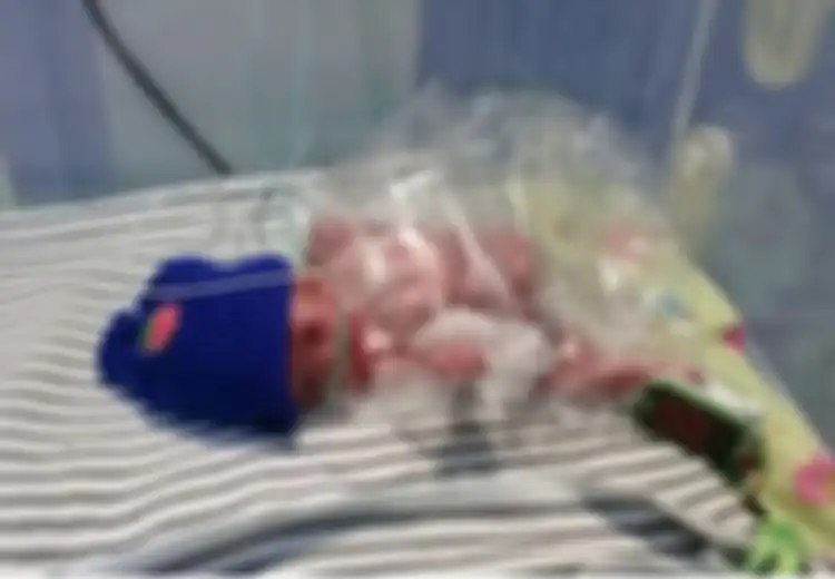 Dokter Bilang Hanya Bisa Selamatkan Nyawa Sang Ibu, Alhasil Bayi Mungil Ini Harus Berjuang Keras Untuk Tetap Hidup