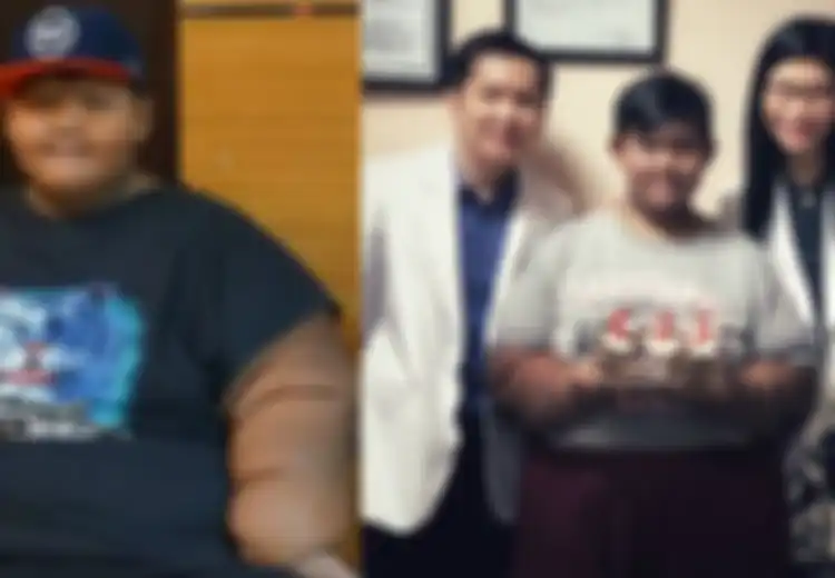 Dulu Beratnya 193 Kg, Kini Aria si Bocah Obesitas Sukses Hilangkan Lemak 70 Kg. Begini Hasilnya!