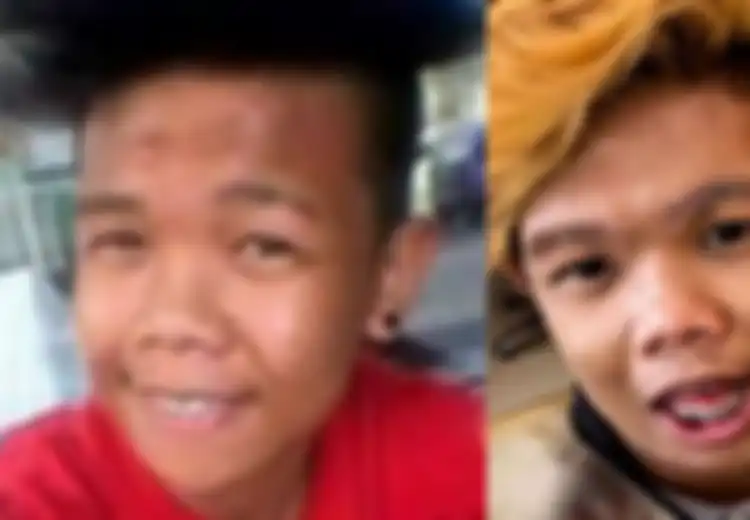 (Foto) Dibully 'Babang Tamvan' di Filipina, Pria Ini Putuskan Operasi Plastik, Hasilnya? Para Wanita Ngantre!
