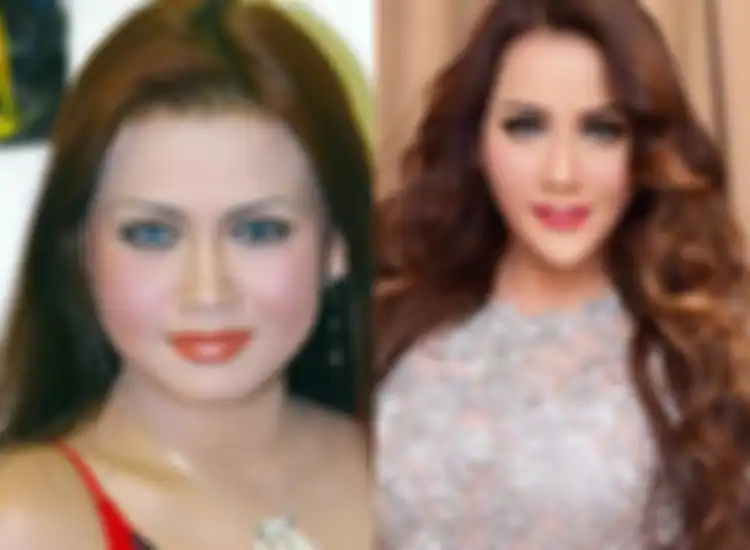 Nita Thalia lakukan operasi plastik sampai alami kelumpuhan wajah