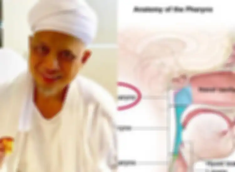 Renggur Nyawa Ustaz Arifin Ilham, makanan ini bisa jadi pemicunya