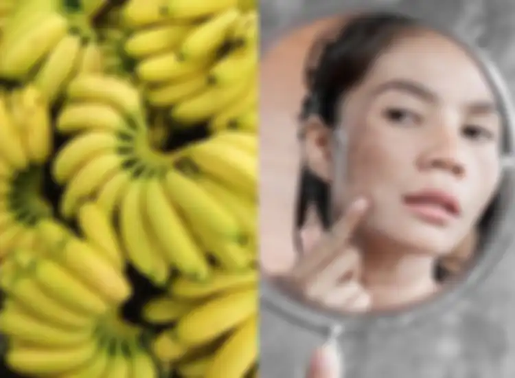 Dengan bermodalkan 1 pisang bisa bikin wajah jadi bebas dari noda hitam.