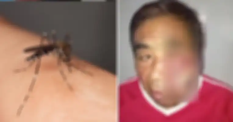 Seorang Pria Nyaris Kehilangan Nyawa Setelah Menggaruk Gigitan Nyamuk di Wajahnya