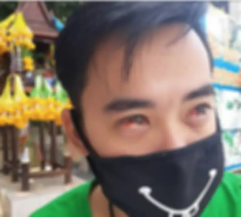 Polusi di Bangkok sangat parah sehingga darah bisa keluar dan mata, serta hidung saat bersin.