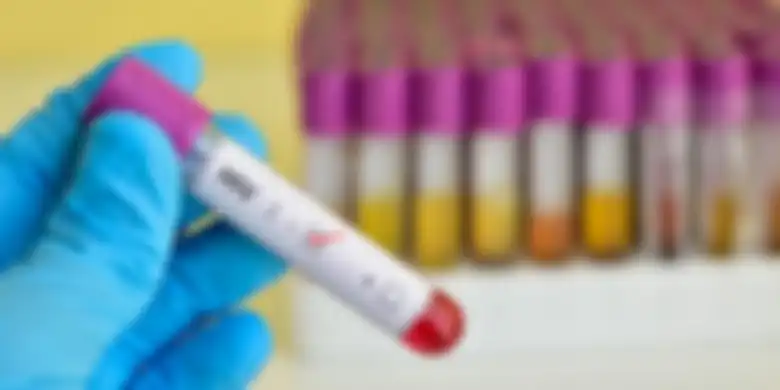 Ilustrasi HIV/AIDS