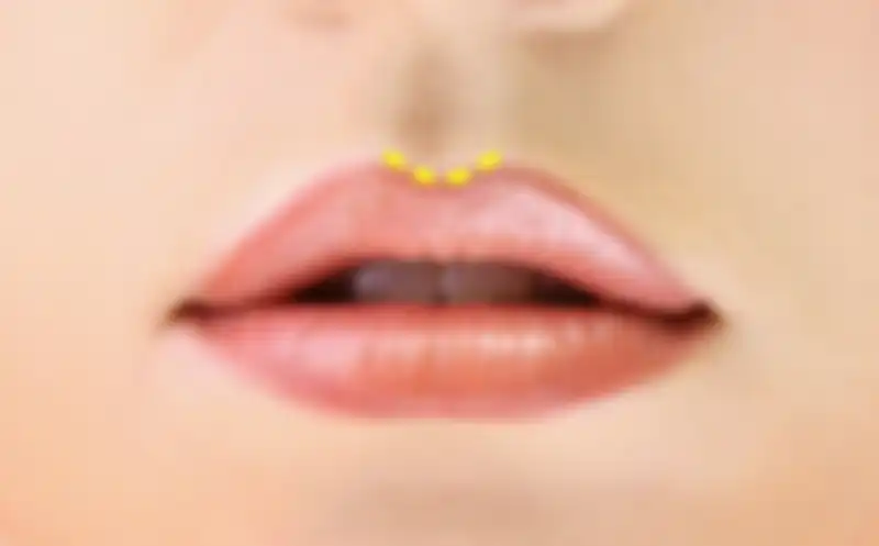 Rounded Cupid’s Bow