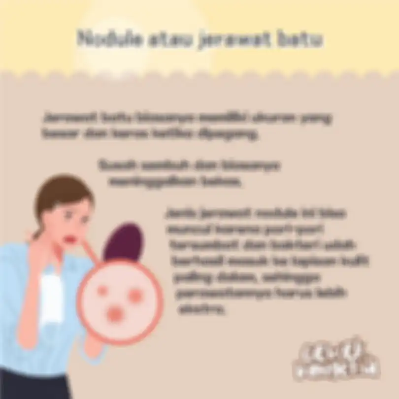 Nodule atau Jerawat Batu