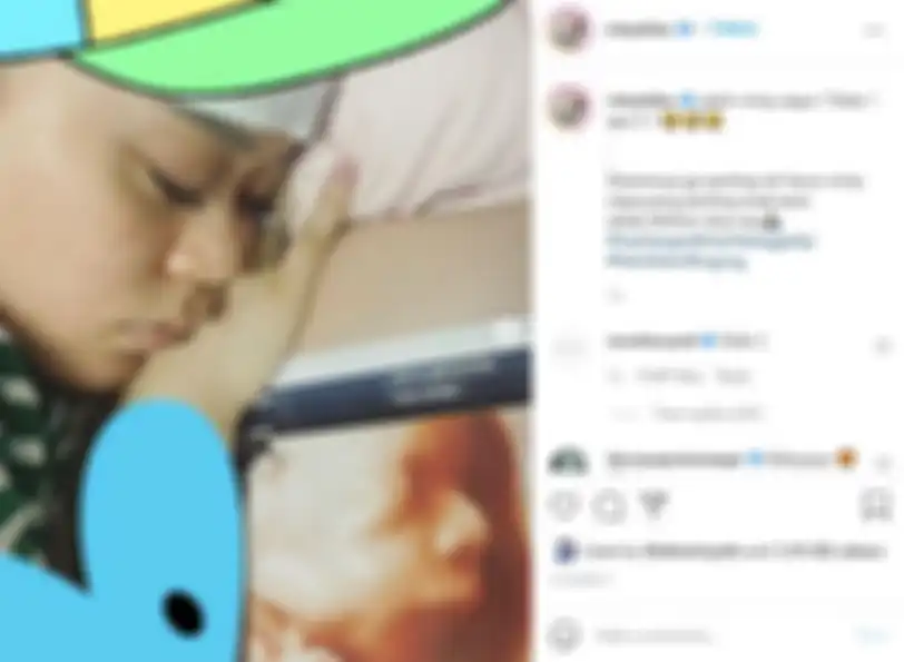 Hasil USG anak pertama Rizky Billar dan Lesti Kejora
