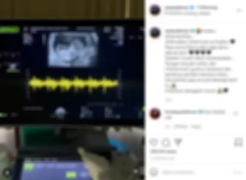 Postingan Atta Halilintar umumkan kehamilan Aurel Hermansyah