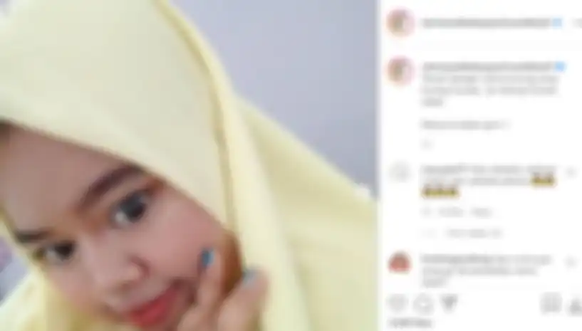Kekeyi setelah melakukan filler hidung