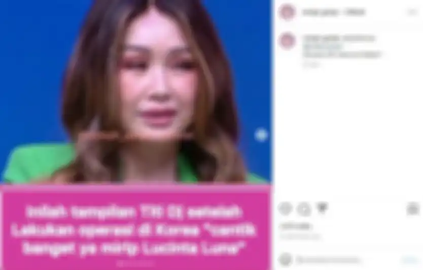 Titi DJ disebut mirip Lucinta Luna usai operasi plastik