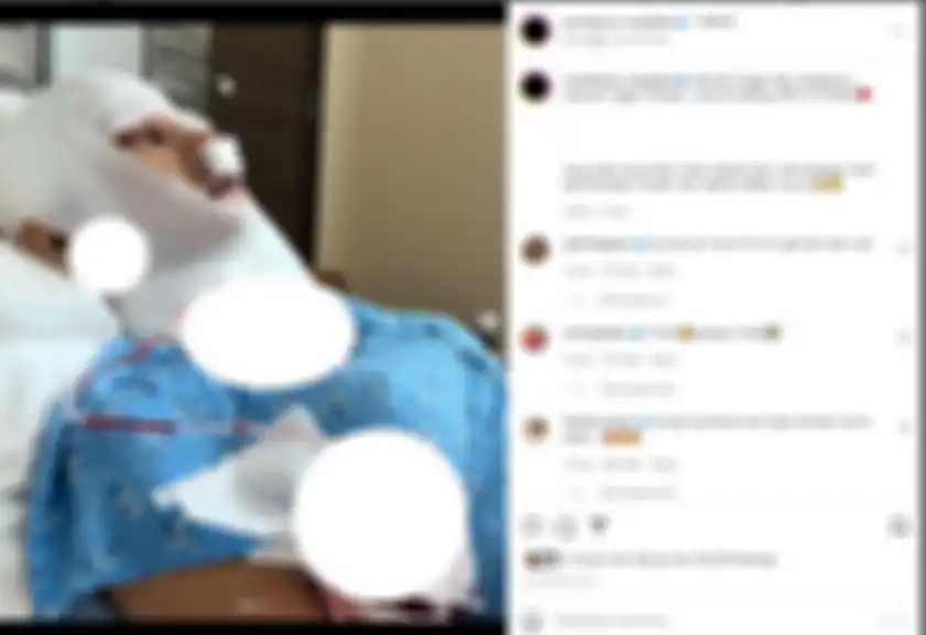 Unggahan Lucinta Luna operasi plastik lagi.