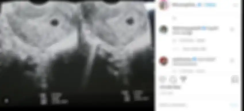 Postingan Felicya Angelista