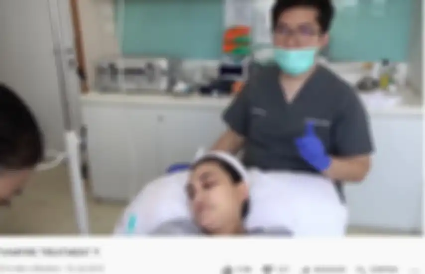 Luna Maya lakukan vampire treatment demi wajah awet muda