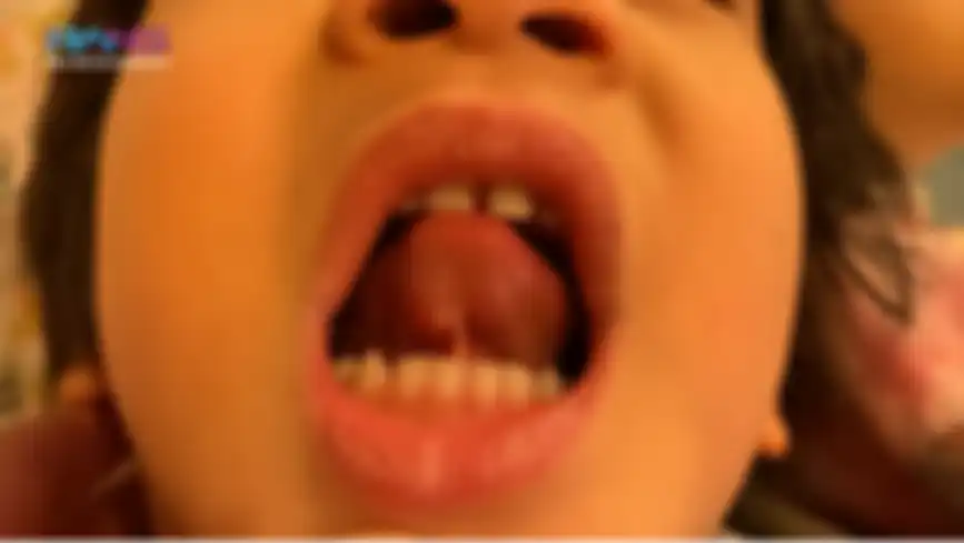 Benjolan di lidah Rafathar