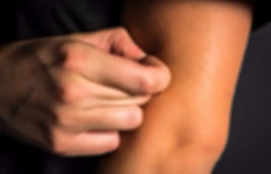 Ilustrasi mencubit-cubit kulit pada pengidab Body-focused Repetitive Behavior